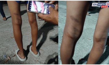 दुचाकीचे नुकसान केल्याच्या संशयावरून शिक्षकाकडून वसतिगृहातील ३२ विद्यार्थ्यांना अमानुष मारहाण